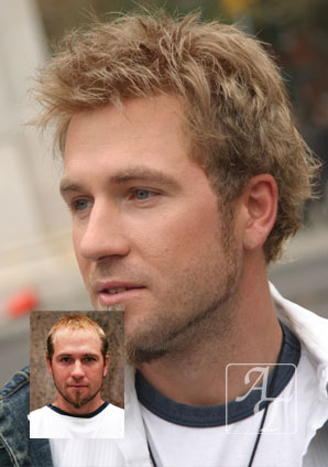 mens-hair-loss-treatment-options-richmond-va mens hair loss treatment richmond virginia